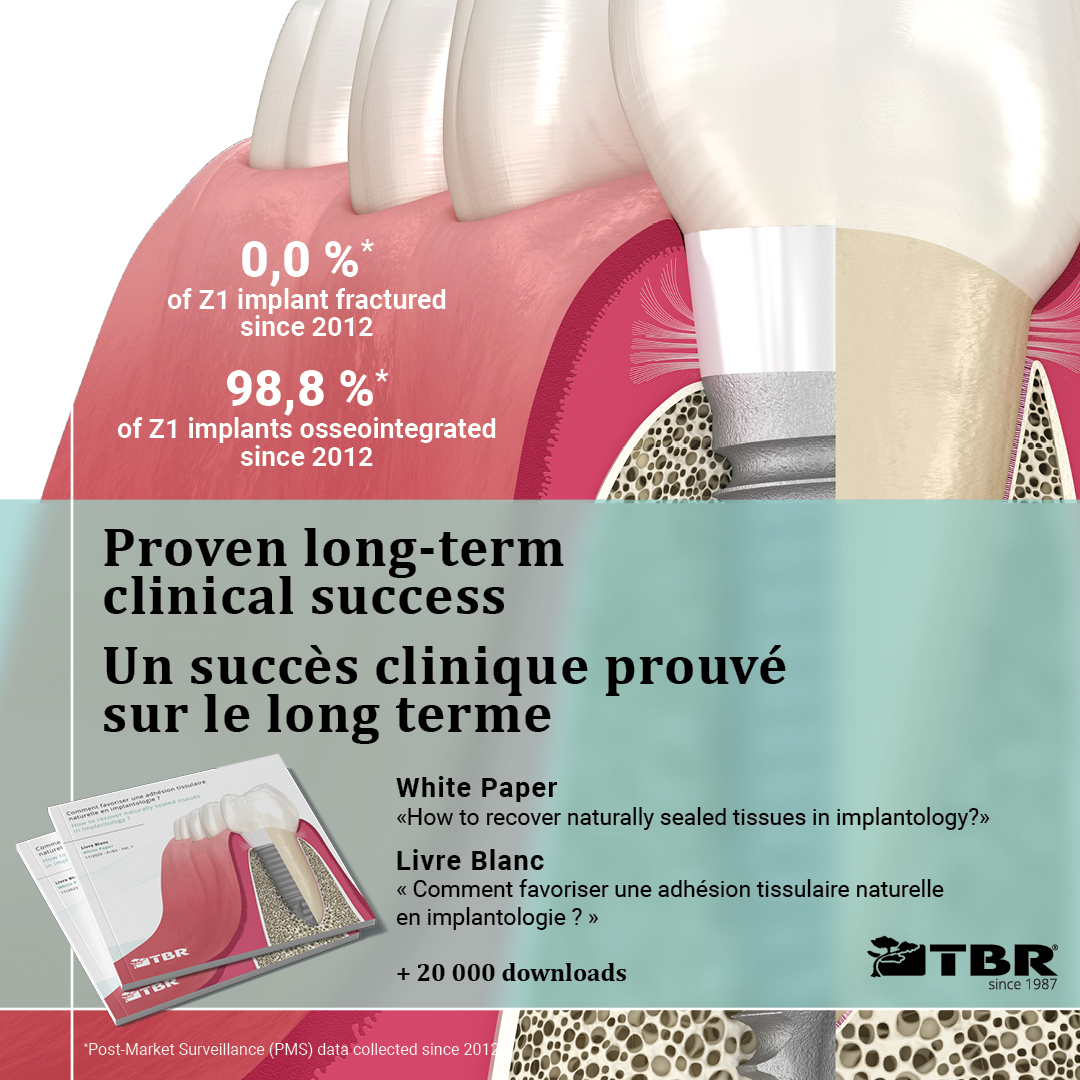campagne-Z1-3